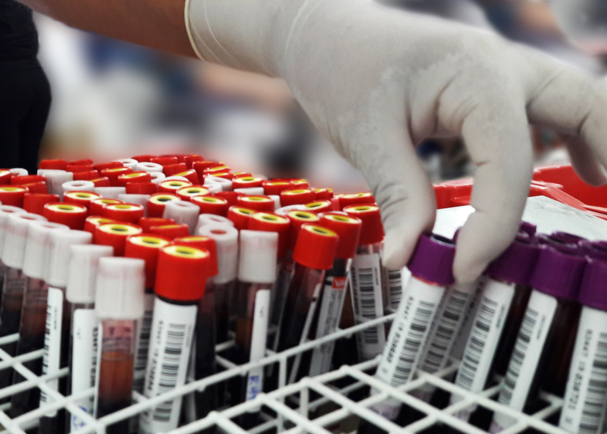 ​Mais de 1,8 milhão de exames laboratoriais são realizados em Santa Bárbara